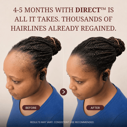 VIORAN Direct™ - Red Light Scalp Massager